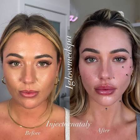 Personalized facial balancing consultation